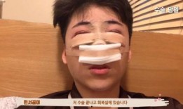 整形爆料视频大全最新版,网红整形视频大全大揭秘