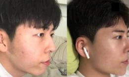 整形爆料视频大全最新版,网红整形视频大全大揭秘